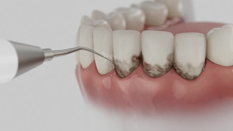 Reliable Dental Implants contractor in Union County County, TN by Dentist Open Now